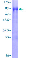 12.5% SDS-PAGE Stained with Coomassie Blue.